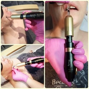 Hialuron pen 5.jpg