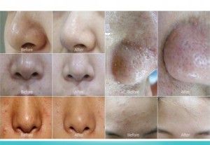 e9baae9e4779bf301d7c19016a57