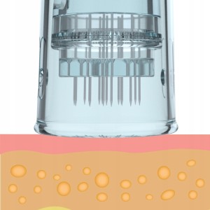 fe3bfa304eebb43f82b495cee3c3